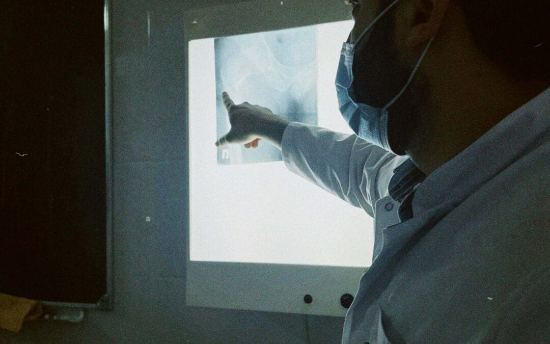 an image of a doctor looking at the results of an x-ray
